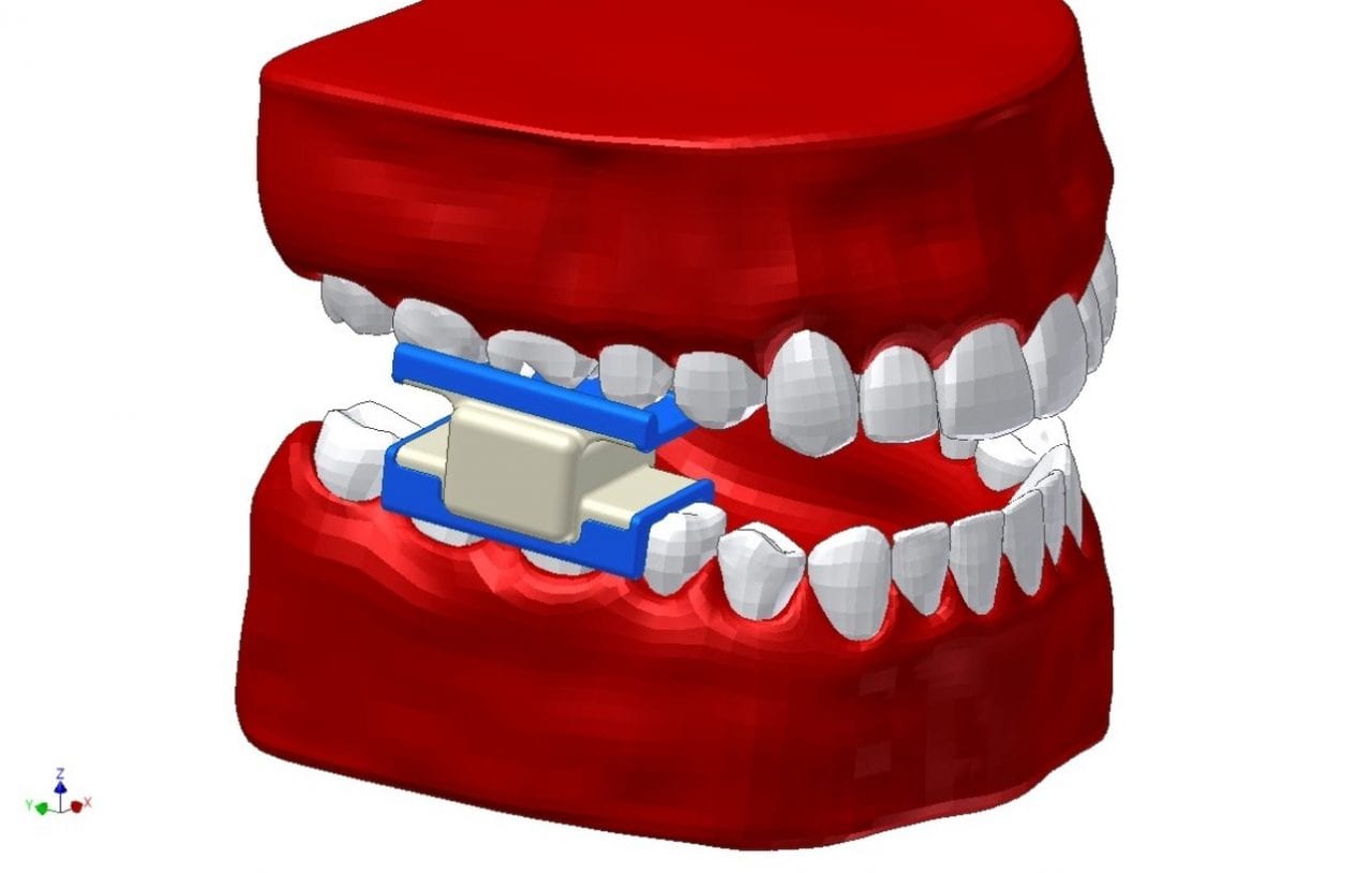 Стоматология по вызову (ВИДЕО)