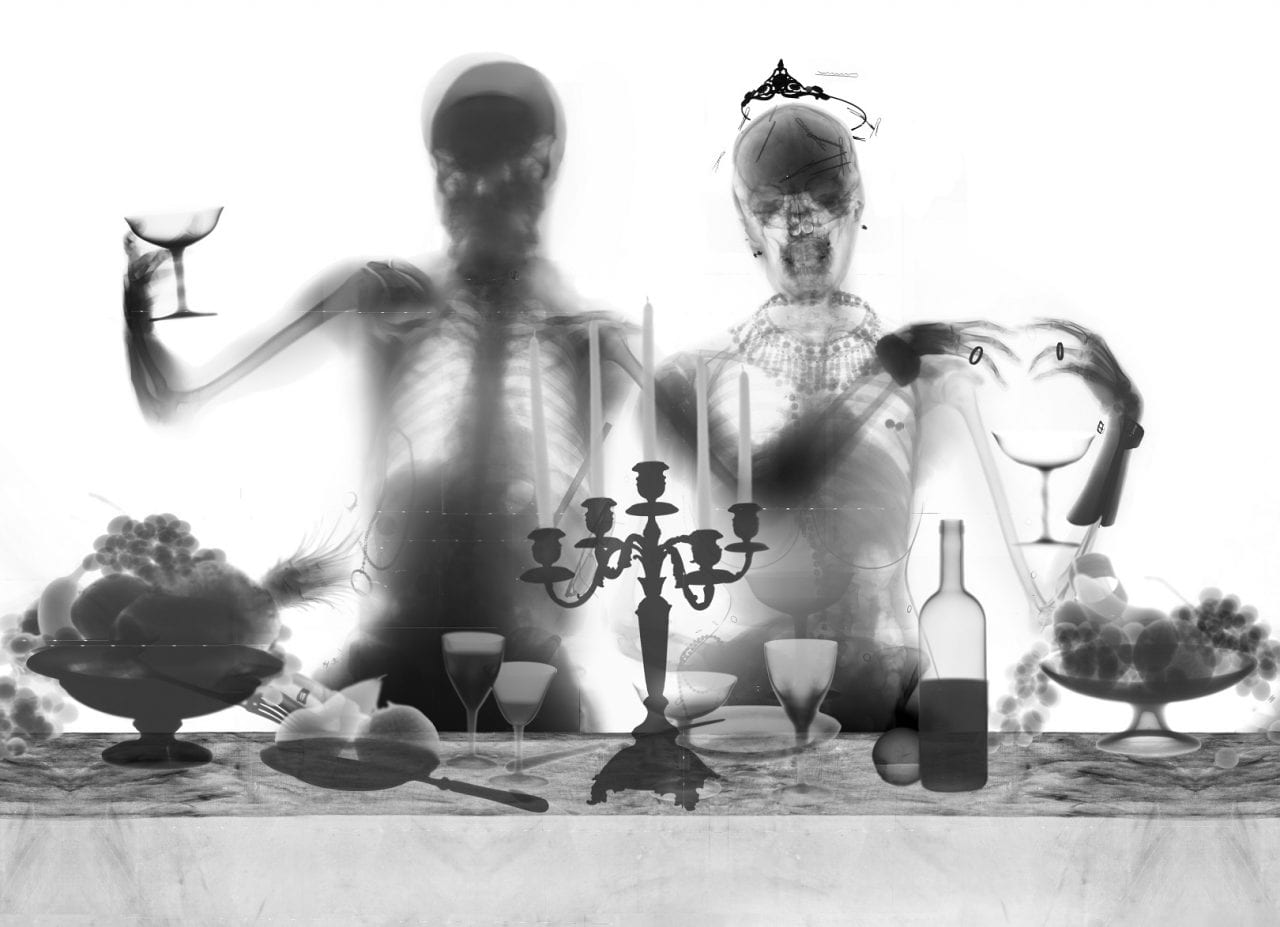 Как выглядит рентген русалки