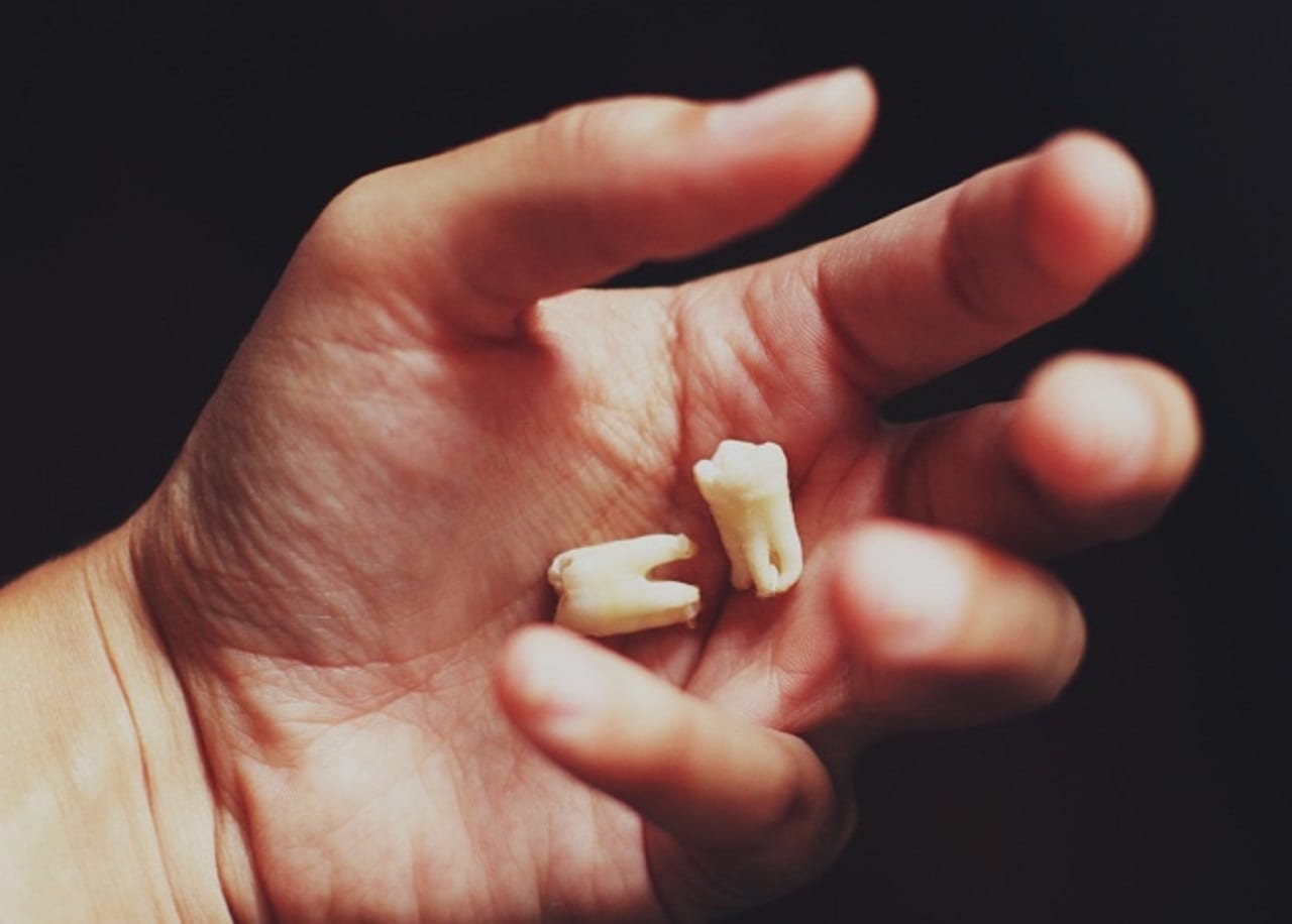 Чем меньше зубов – тем меньше ума. Доказано наукой