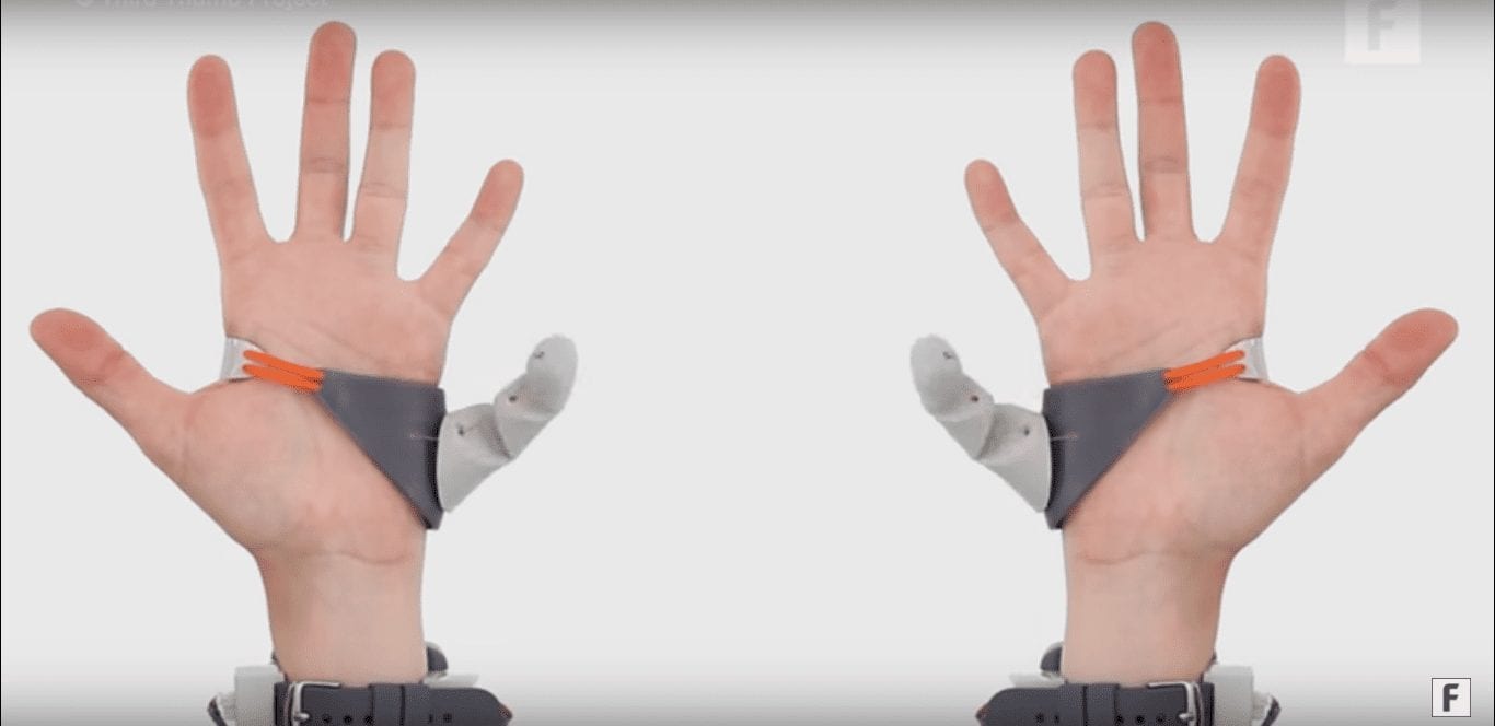 Шестой палец и другие. Восемь технологий, которые приближают будущее