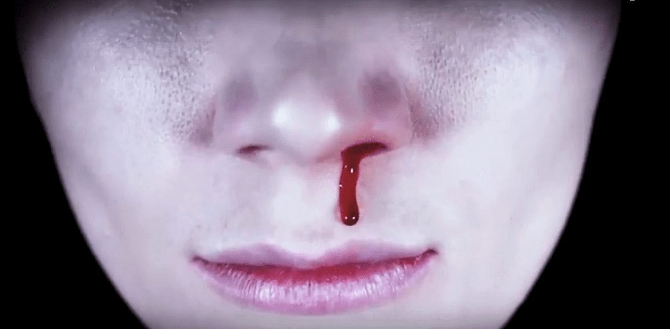 Необычная одежда напомнила о Дне Гемофилии