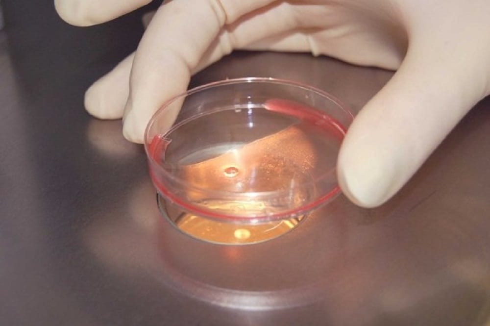 Создан тест, который предсказывает уровень интеллекта ребенка до его рождения