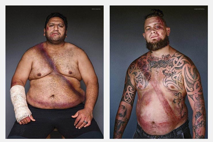 Участники ДТП показали, как ремни безопасности спасли им жизнь