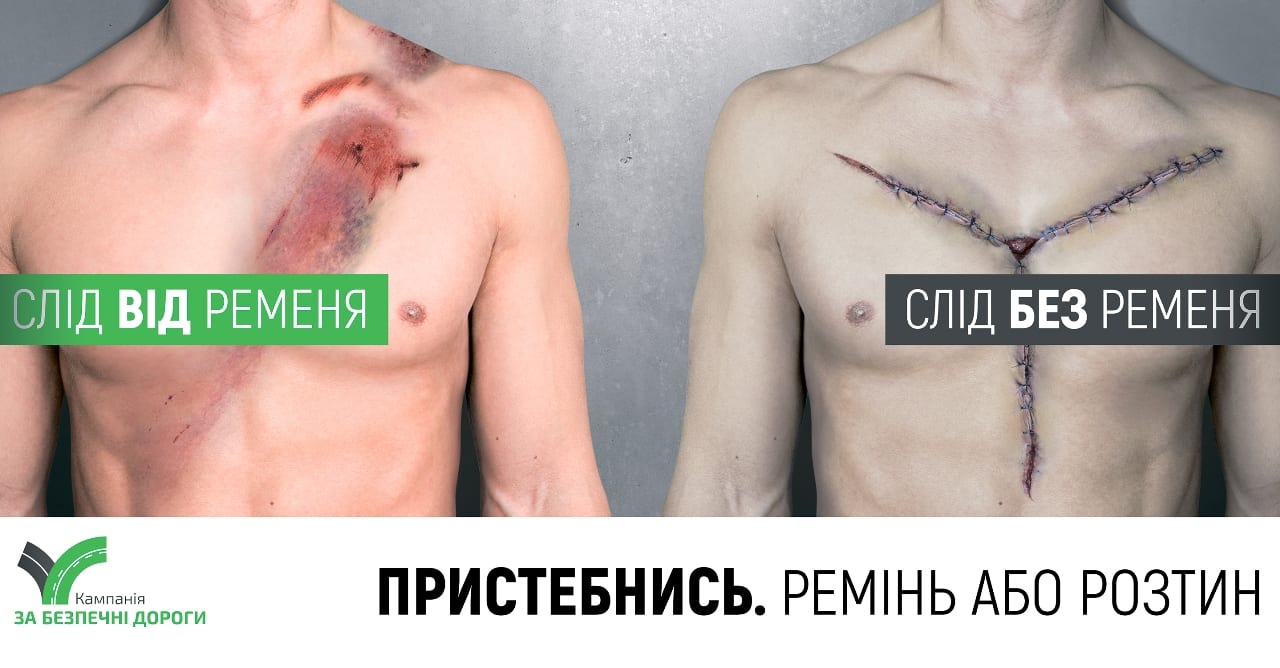 Ремінь або розтин: як заохотити українців користуватися пасками безпеки